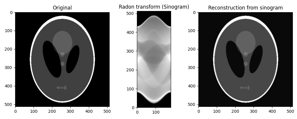 Original, Radon transform (Sinogram), Reconstruction from sinogram